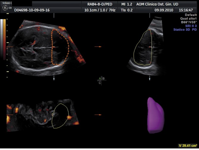 Fig. 2