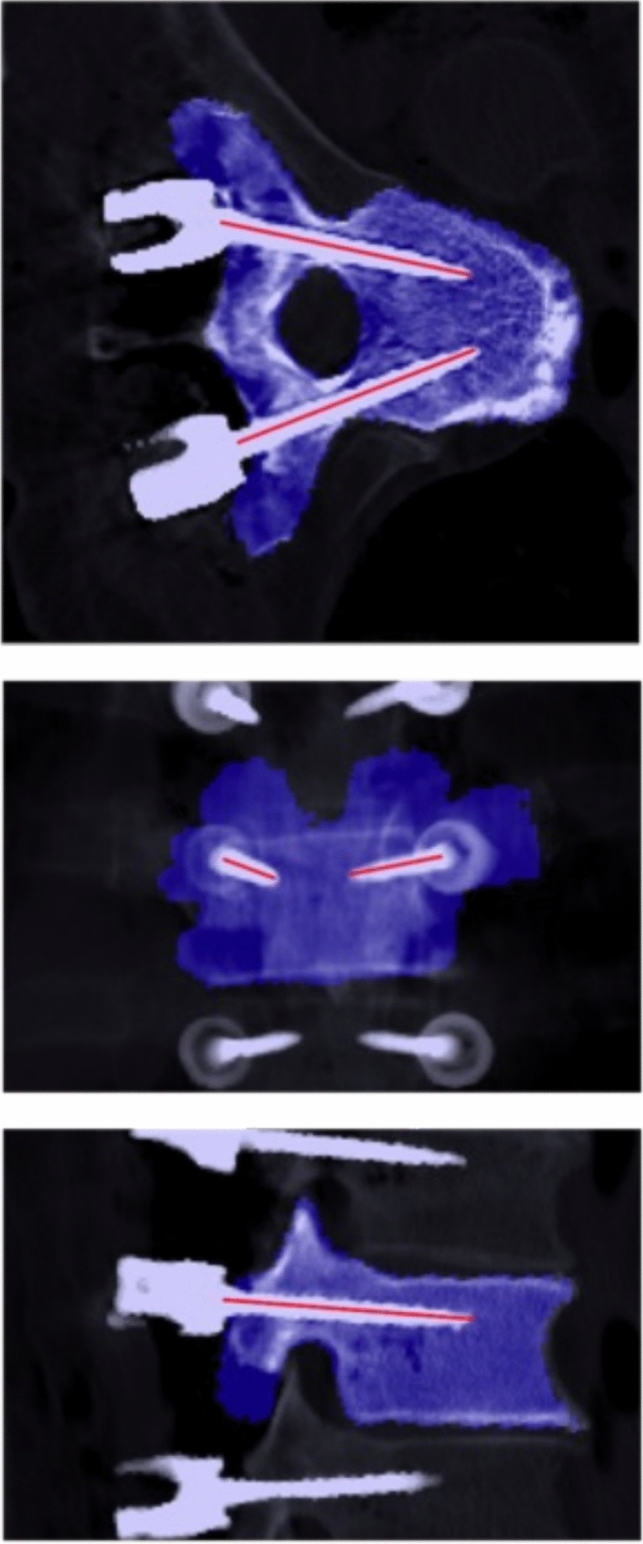 Fig. 2