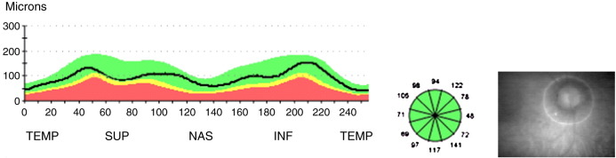 Fig. 1