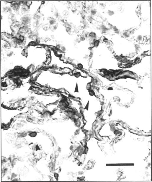 FIGURE 1. B