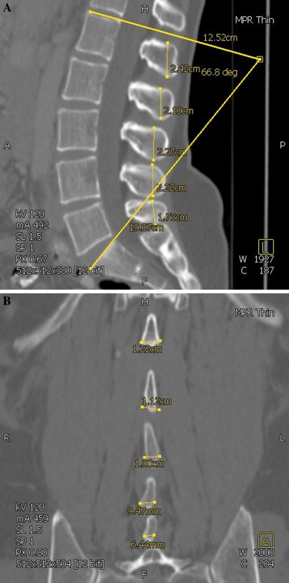 Fig. 1