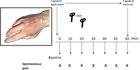 Fig. 1