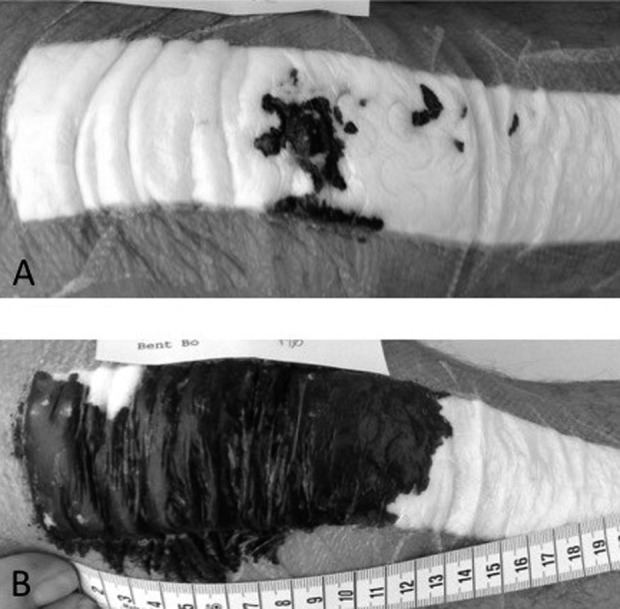 Fig. 2 A-B