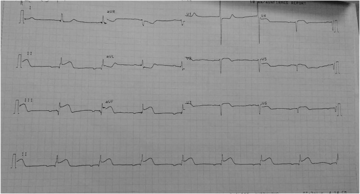 Fig. 1