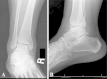 Fig. 2A–B