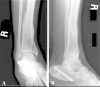 Fig. 1A–B