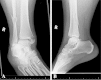 Fig. 4A–B