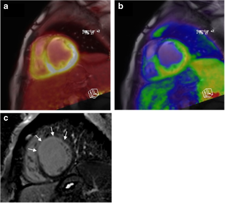 Fig. 4