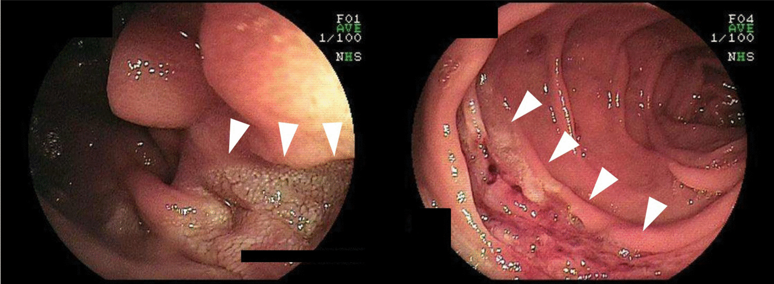 Fig. 5