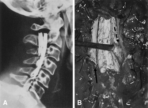 Fig. 2A–B