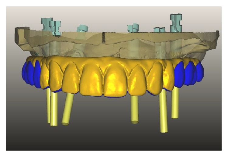 Figure 4