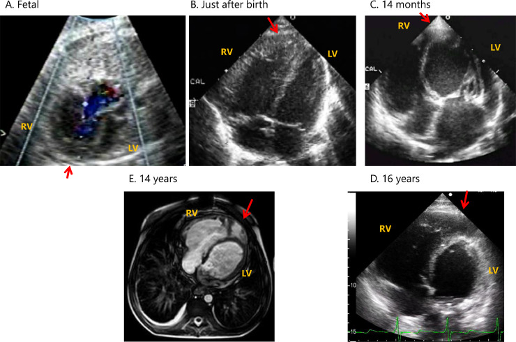 Fig. 1