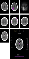 Fig. 4