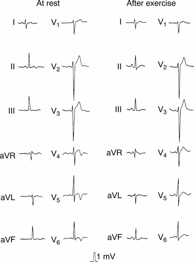 Figure 4:  