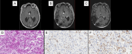 Fig. 3