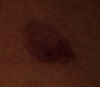 Fig. 15