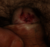 Fig. 12