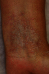 Fig. 14