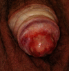 Fig. 13