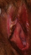 Fig. 1