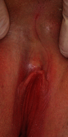 Fig. 4