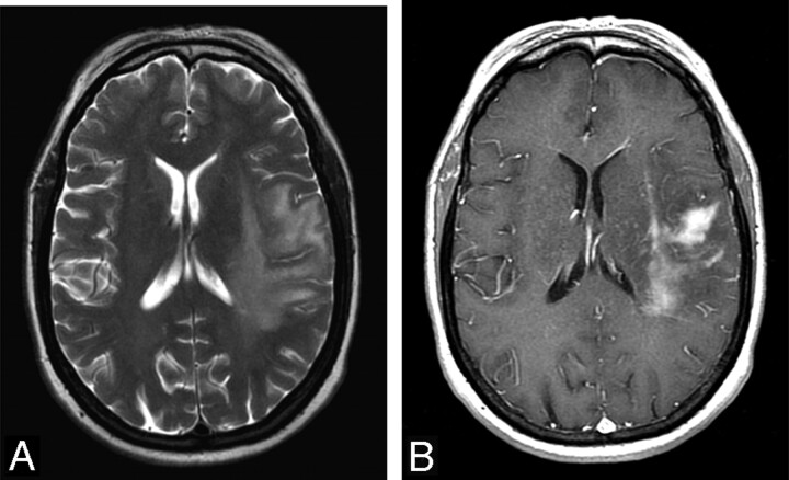 Fig 2.