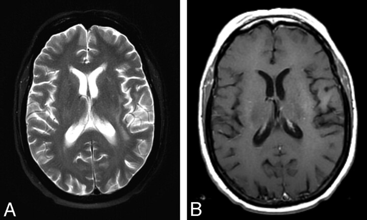 Fig 3.