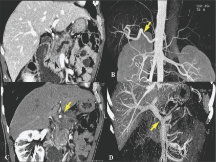 Figure 6 (A-D)