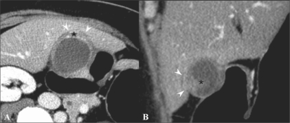 Figure 8 (A,B)