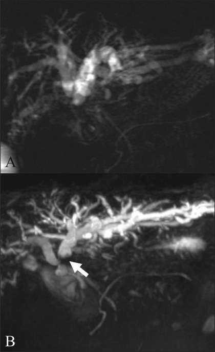 Figure 17 (A,B)