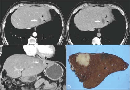 Fig. 14 (A-D)