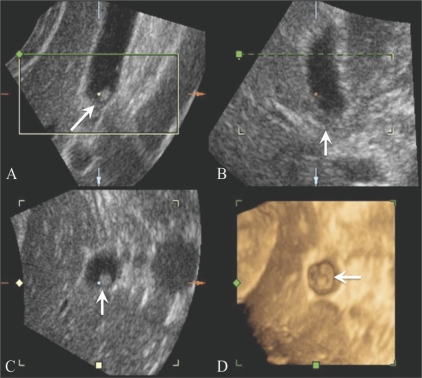 Figure 2 (A-D)