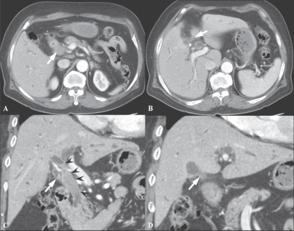 Figure 4 (A-D)