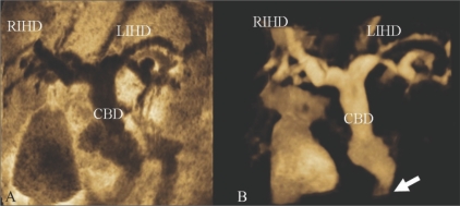 Figure 3 (A,B)