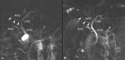 Figure 16 (A,B)