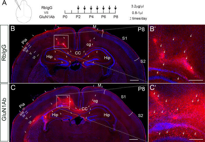 Figure 4—figure supplement 1.