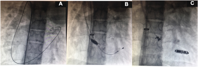 Fig. 1