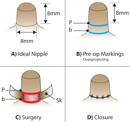 Figure 1)