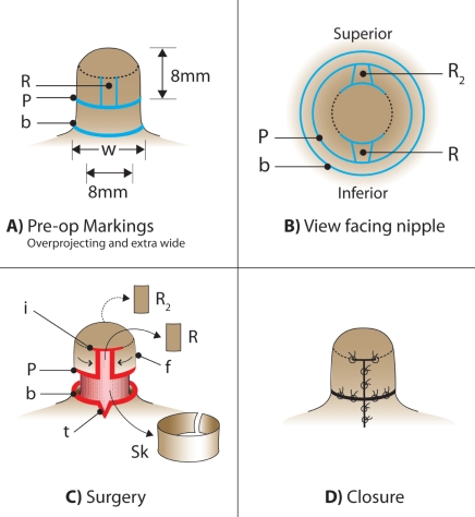 Figure 2)