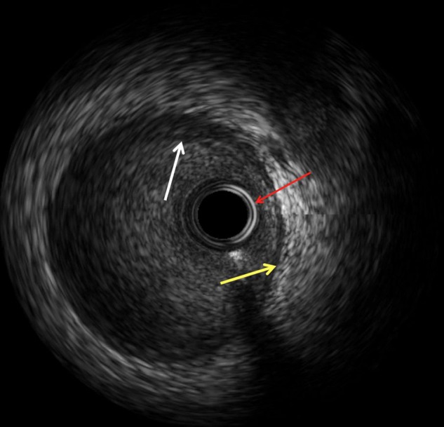 Figure 1