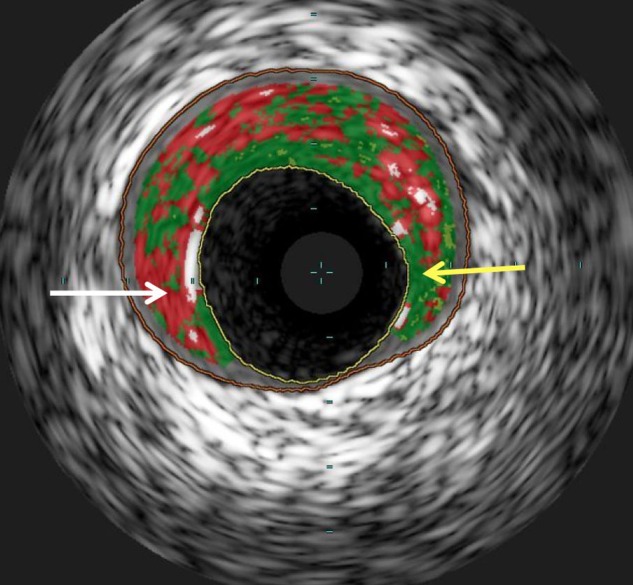 Figure 2