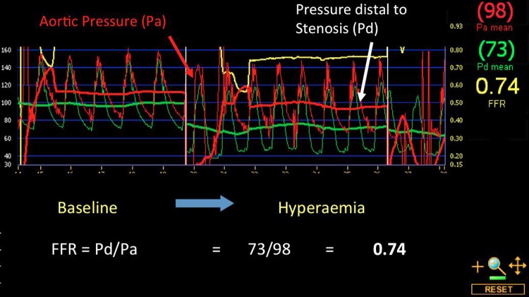 Figure 3