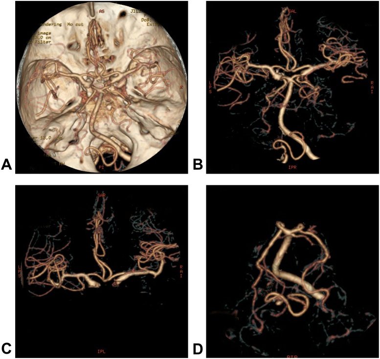 Fig. 4