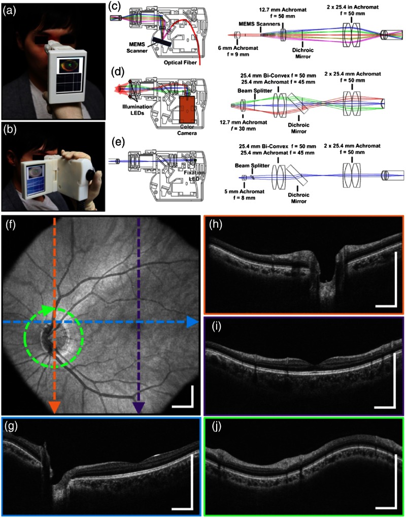 Fig. 14