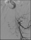 Fig 10