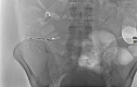 Fig 7