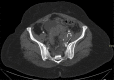 Fig 9