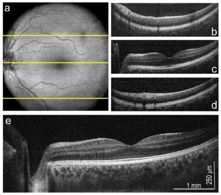 Fig. 9