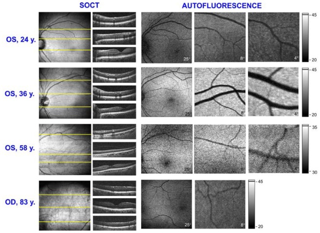 Fig. 11