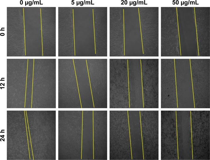 Figure 11